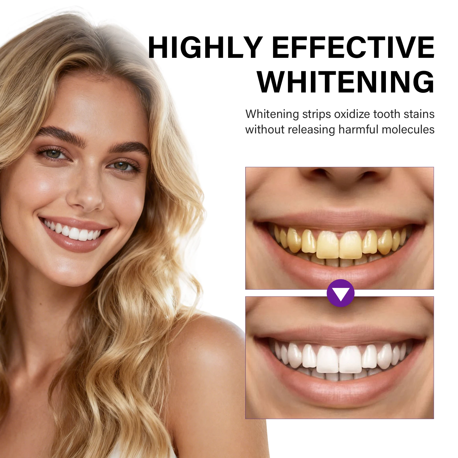 5 Stück Zahnaufhellungsstreife – Teeth Whitening Home Kit Bewertung und Preis