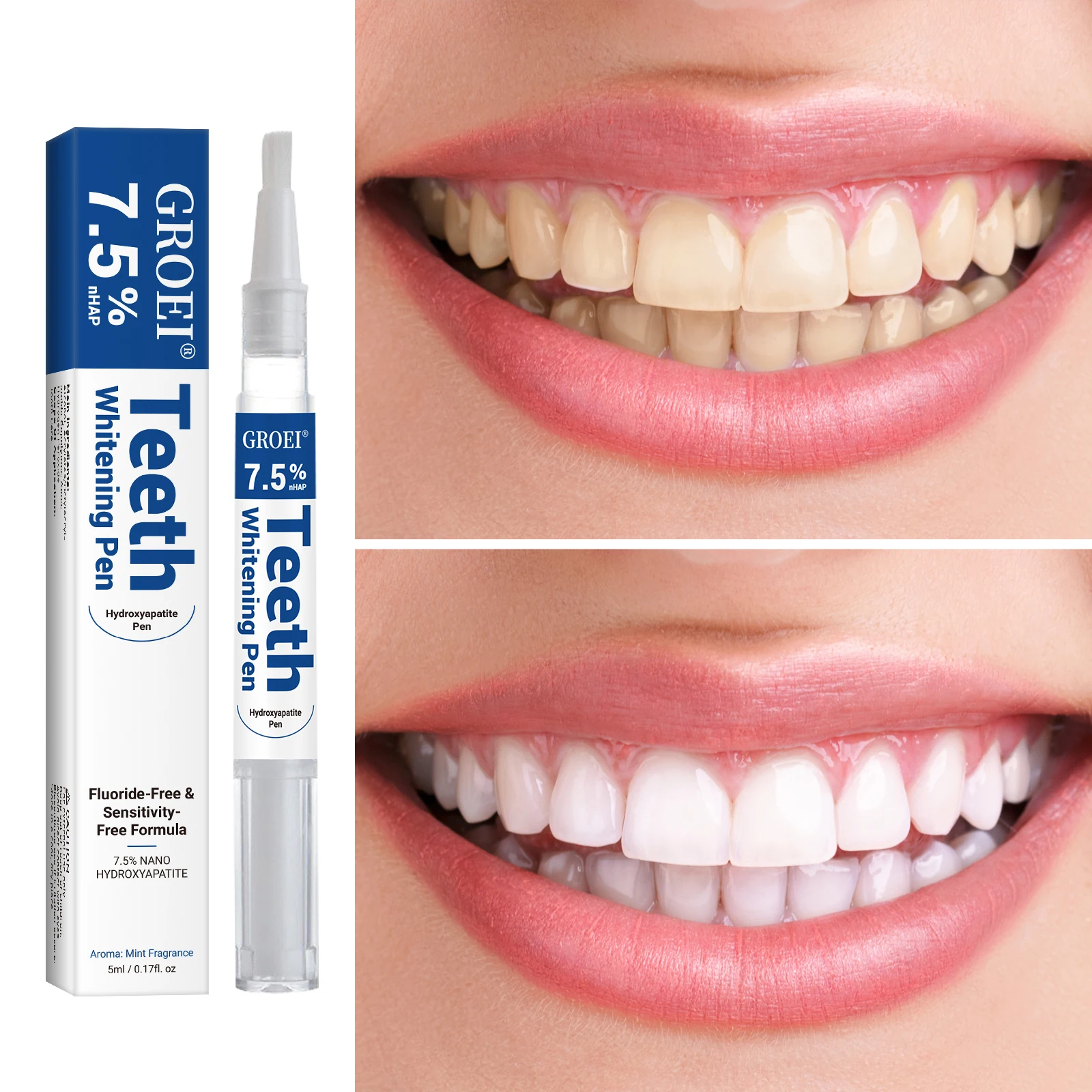 Hydroxyapatite Zahnaufhellungs – Teeth Whitening Procedure Bewertung und Preis