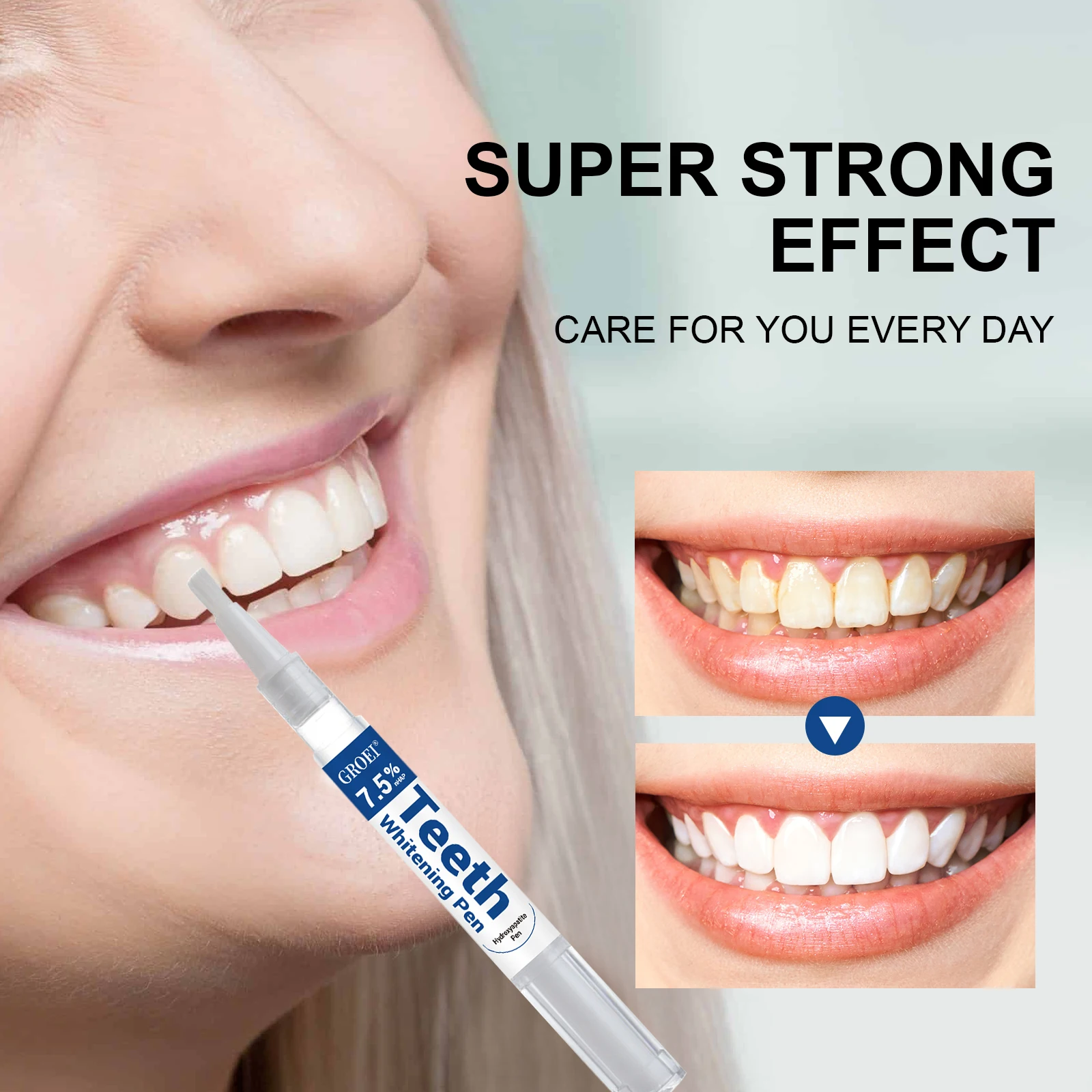 Hydroxyapatite Zahnaufhellungs – Teeth Whitening Procedure Bewertung und Preis