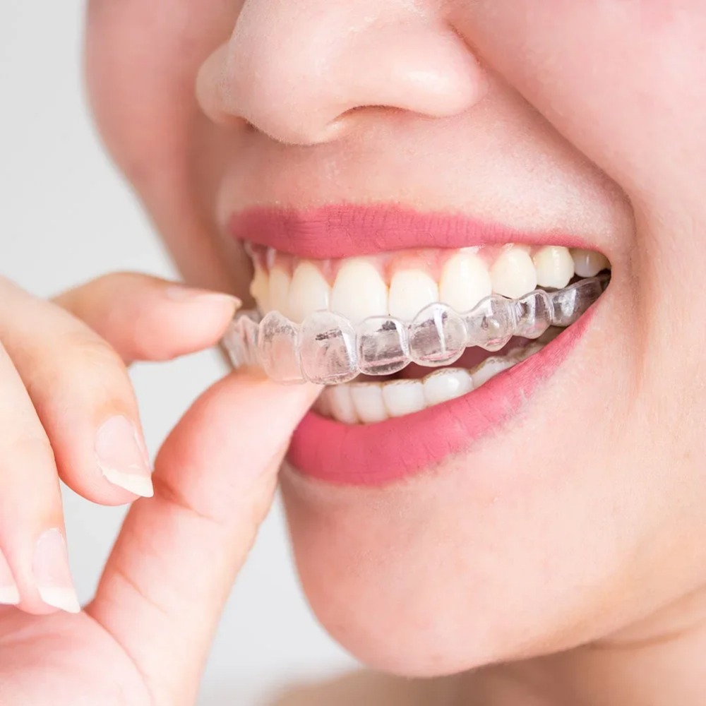 1-4 Stück Anti-Schnarch- und B – Dental Guard Night Bewertung und Preis