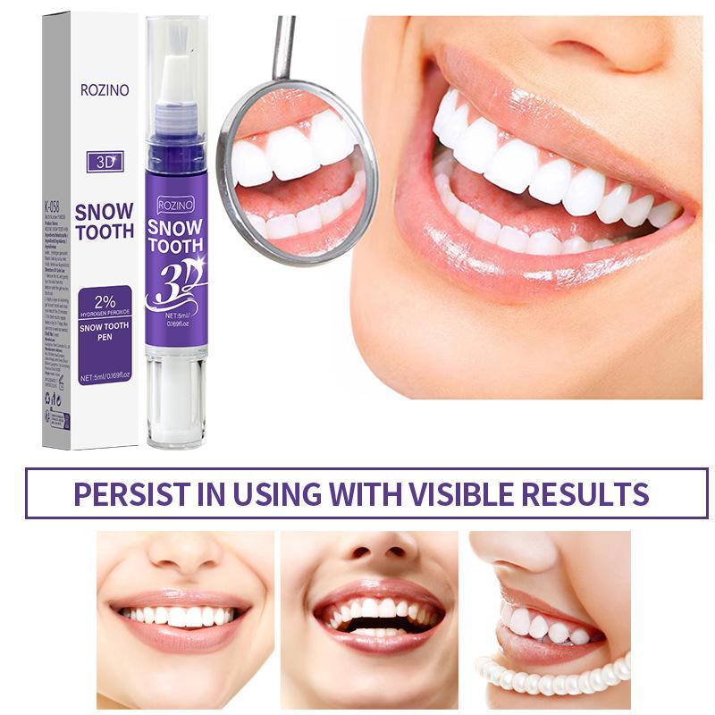 Tragbarer Zahnaufhellungsstift – Whitening Pen Bleach Bewertung und Preis