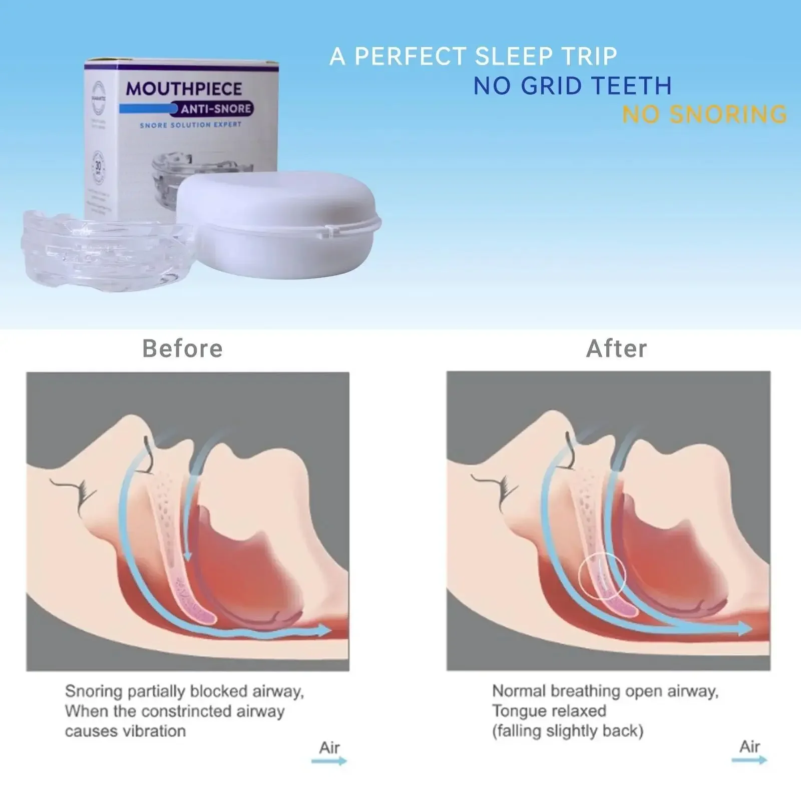 Verstellbarer Anti-Schnarch-Mu – Dental Guard Night Bewertung und Preis