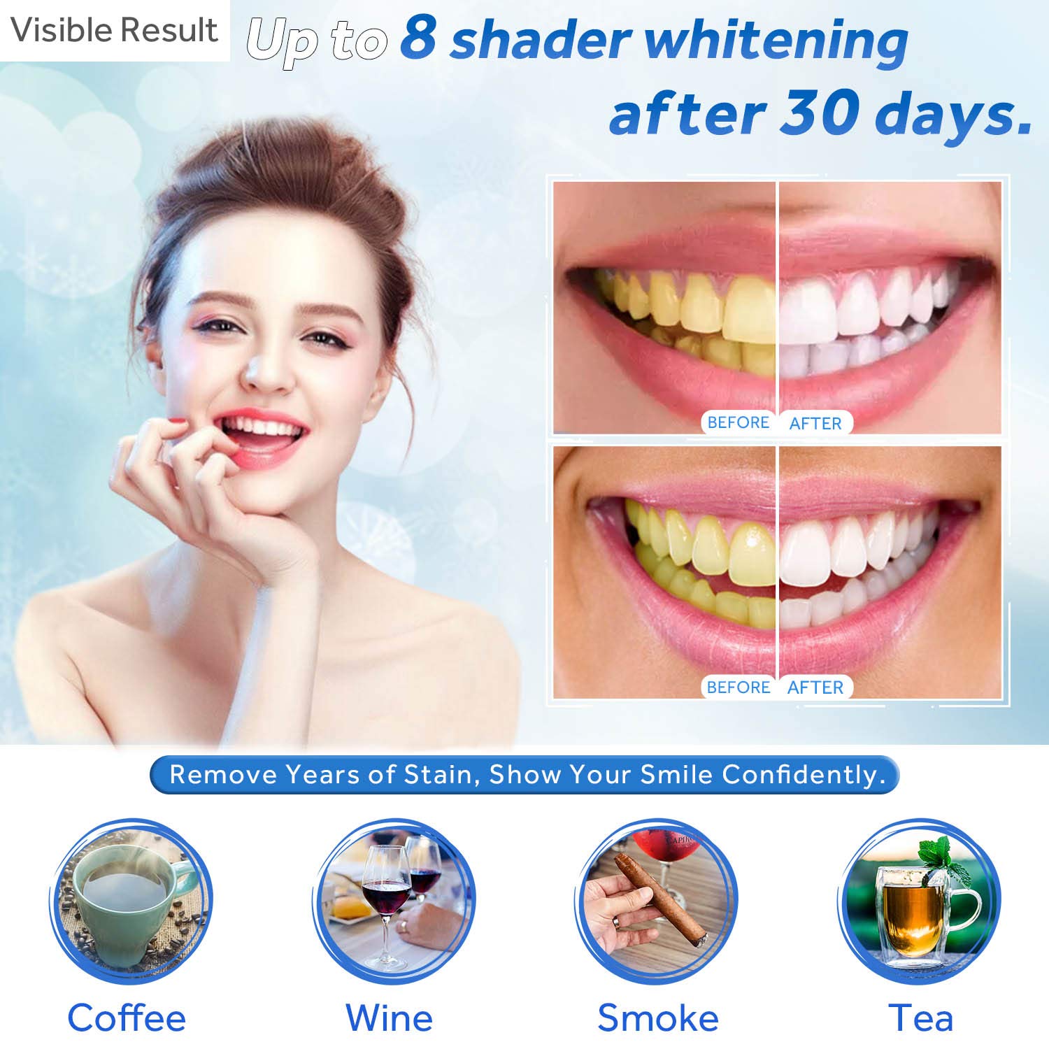 Zahnaufhellungsgel, Nachfüllsp – Teeth Whitening Procedure Bewertung und Preis