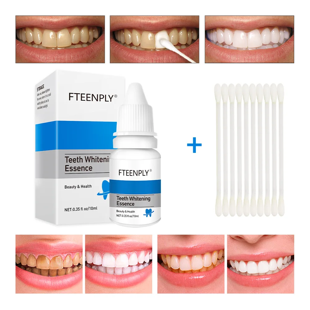 FTEENPLY Zahnaufhellung Essenz – Teeth Whitening Procedure Bewertung und Preis