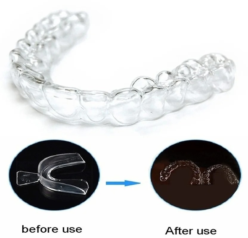 Anti Schnarchen Bruxismus Schl – Dental Guard Night Bewertung und Preis