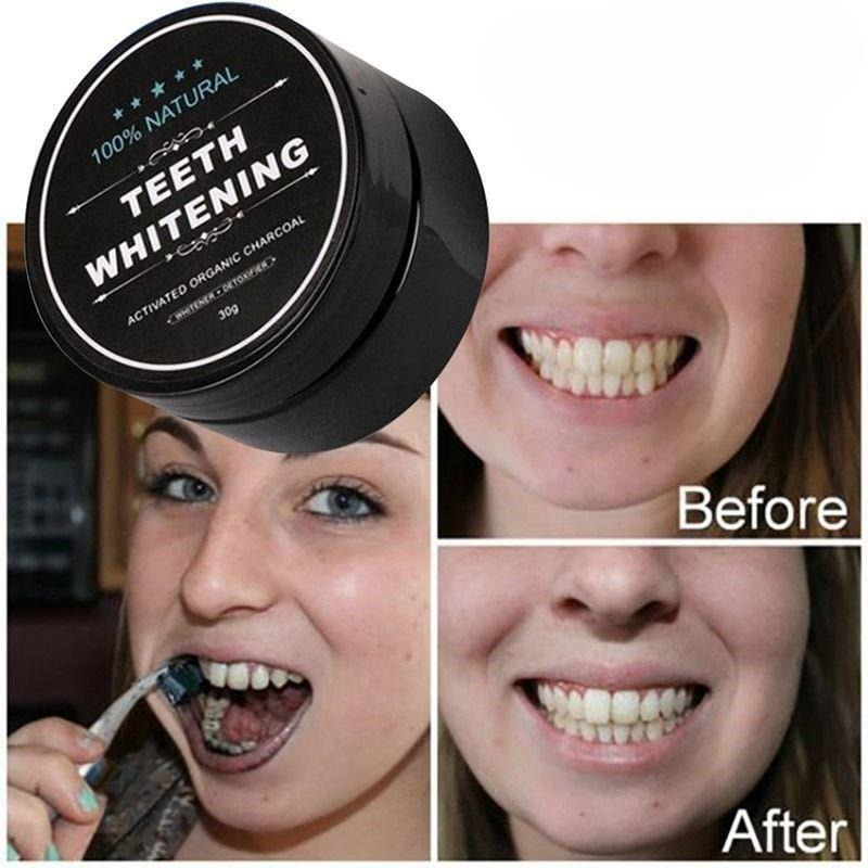 1 Box Aktivkohle-Zahnaufhellun – Teeth Whitening Zimba Bewertung und Preis
