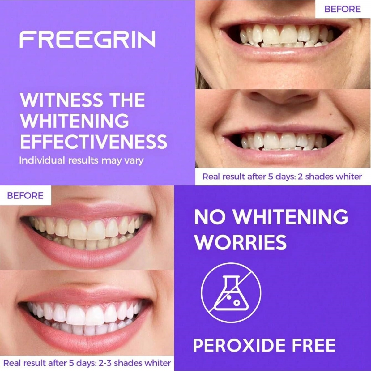 Deluxe Zahnaufhellungsaufklebe – Teeth Whitening Gel Peroxide Bewertung und Preis