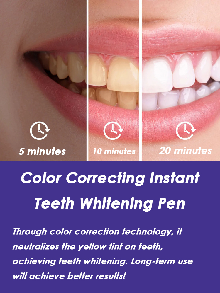 Zahnaufhellungsstift zur Entfe – Whitening Pen Bleach Bewertung und Preis